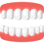 Full Mouth Reconstruction